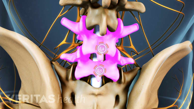Lower spine with L4-L5 spinal segment highlighted.