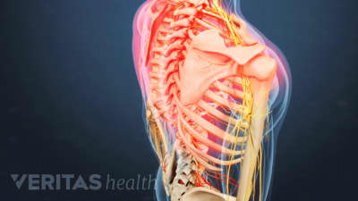 Upper Back Pain