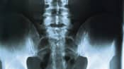 X-ray view of the lumbar spine and pelvis.
