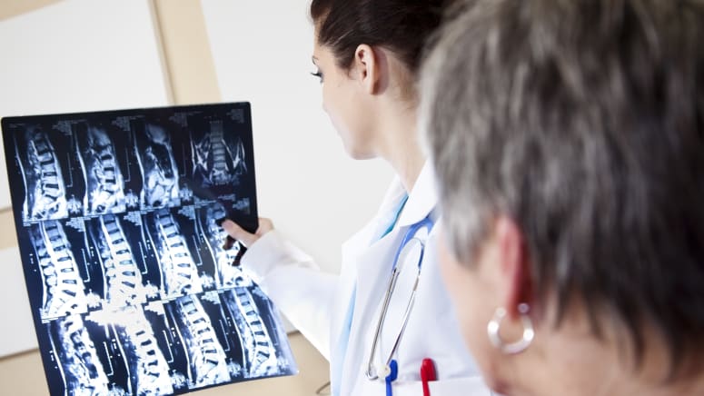 Physician examining a cervical spine xray
