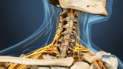 Medical illustration of the cervical spine, nerves are visible.