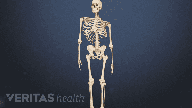 Medical illustration showing scoliosis.