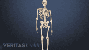 Medical illustration of an adolescent skeleton with scoliosis
