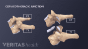 Medical illustration of the cervicothoracic junction that occurs between the C7 and T1 vertebrae