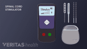 Spinal Cord Stimulator placement showing controller, leads and generator.