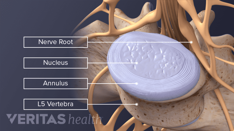 Top-down labeled view of a normal L4-L5 disc.
