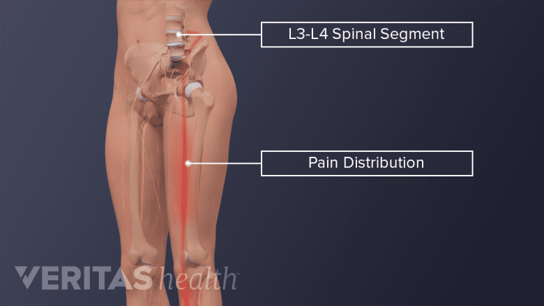 Anatomical illustration of human body with a vertical red line on the left thigh.