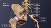 Anterior view of the pelvis labeling L4, L5, S1, S2, S3 and the sciatic nerve.
