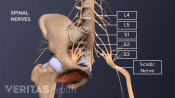 Anterior view of the pelvis labeling L4, L5, S1, S2, S3 and the sciatic nerve.