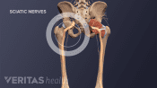 Posterior view of pelvis with sciatic nerve going down the left leg.