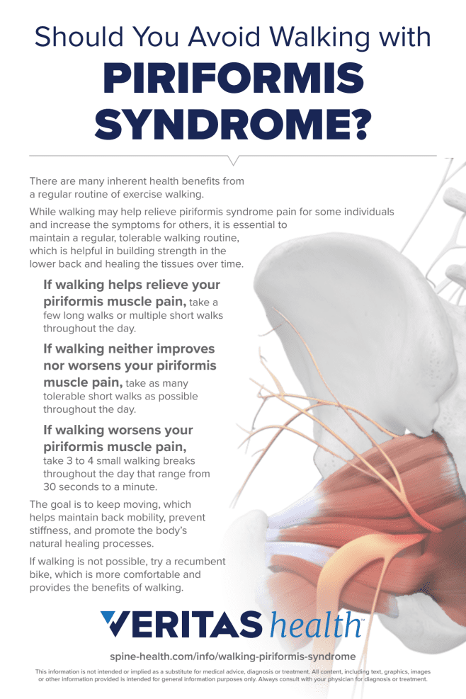 Should You Avoid Walking with Piriformis Syndrome?