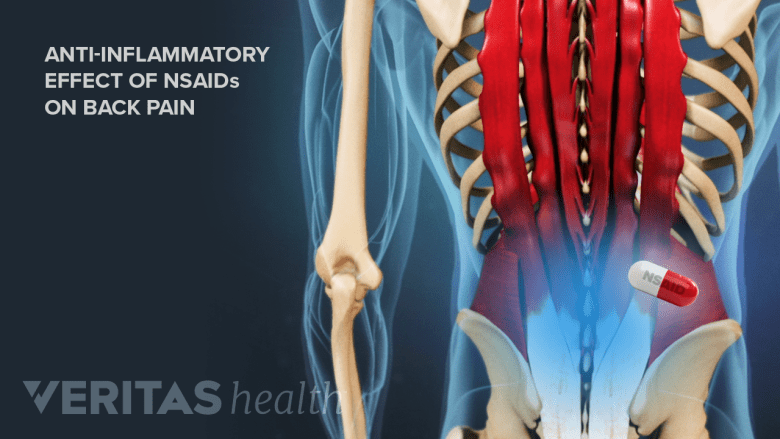 Illustration showing blue highlight  the lower back area with a pill.
