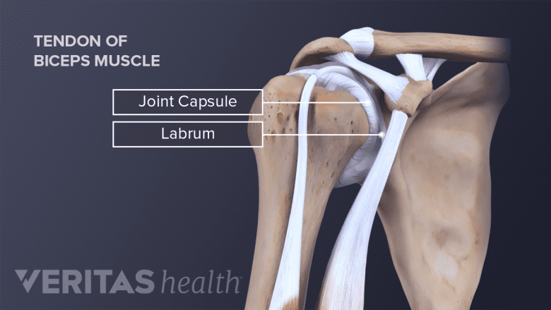 3D image of a shoulder joint with tendon attachments.