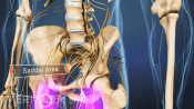 Medical illustration of the bones and nerves in the hips and pelvis. The saddle area is highlighted and labeled.