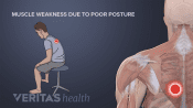 Bad posture weakens muscles