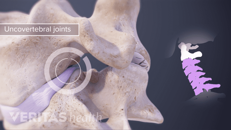 Medical illustration of the anatomy of a typical cervical vertebrae