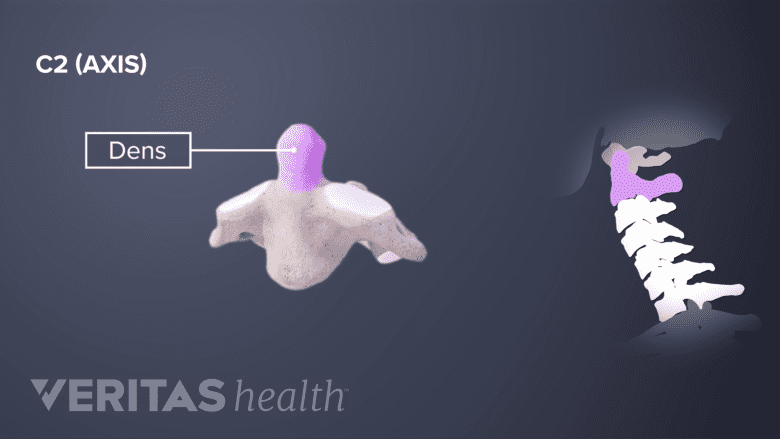 Medical illustration of the odontoid process on the C2 cervical vertebra