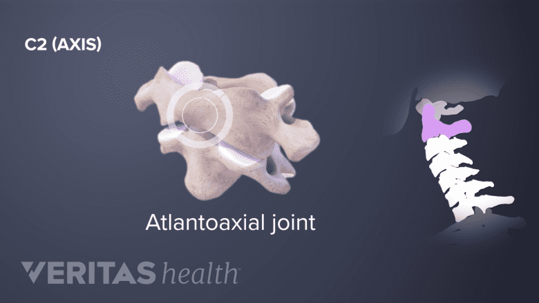 3D rendering of the atlantoaxial joint as seen from the side, next to silhouette of the cervical spine.