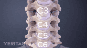 Anterior view of the cervical spine showing C3-C6.