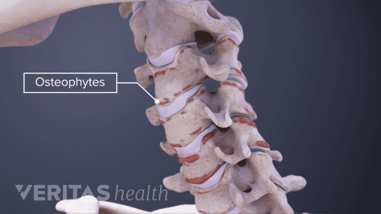 3D image of cervical spine.