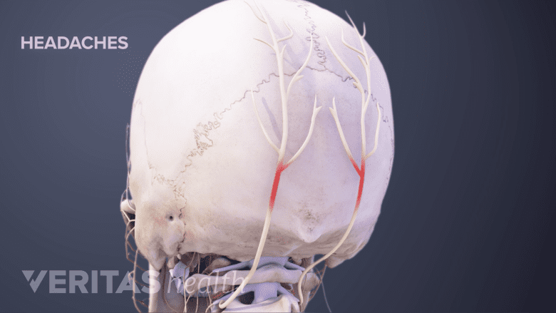 Posterior view of the skull.