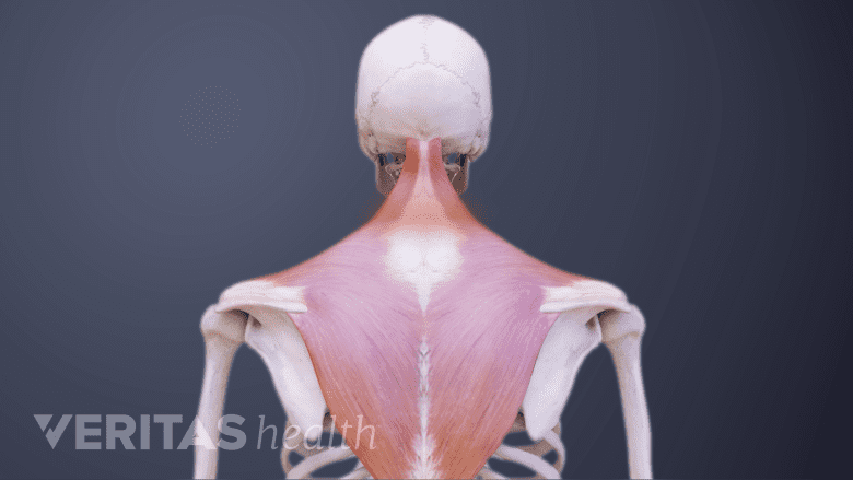Illustration of posterior view of upper body with neck area highlighted in red.