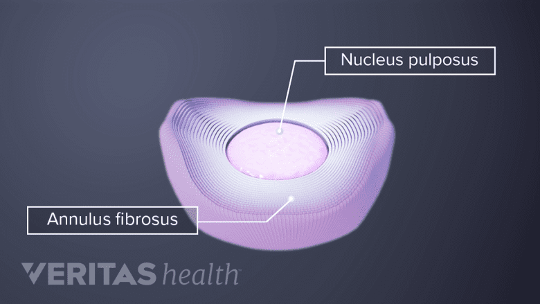 Top down view of the nucleus pulposus and annulus fibrosus of a vertebral disc.