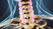 Medical illustration of cervical facet joints