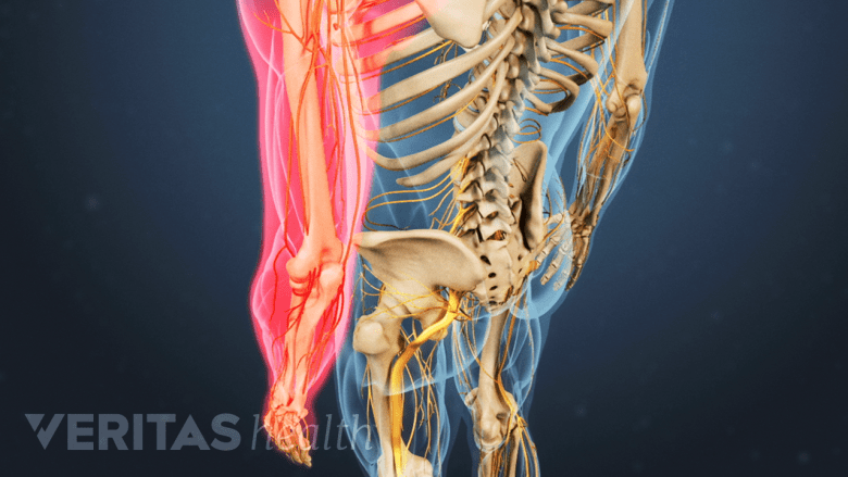 An illiustration showing upper limb highlighted in red.
