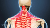 Posterior view of the upper body highlighting pain in the shoulders, neck, and upper back.