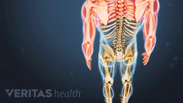 Illustration showing a skeleton with shoulders and arms highlighted in red.