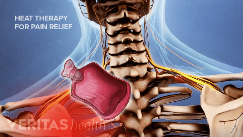Illustration showing heat therapy in the neck area with a hot bag.