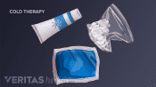 Assortment of cold therapy treatments