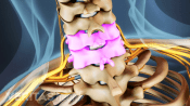 Medical illustration of the cervical spine. C5 and C6 are highlighted.
