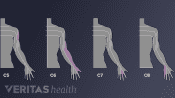 Cervical dermatomes C5, C6, C7, and C8.