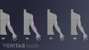 Cervical dermatomes C5, C6, C7, and C8.
