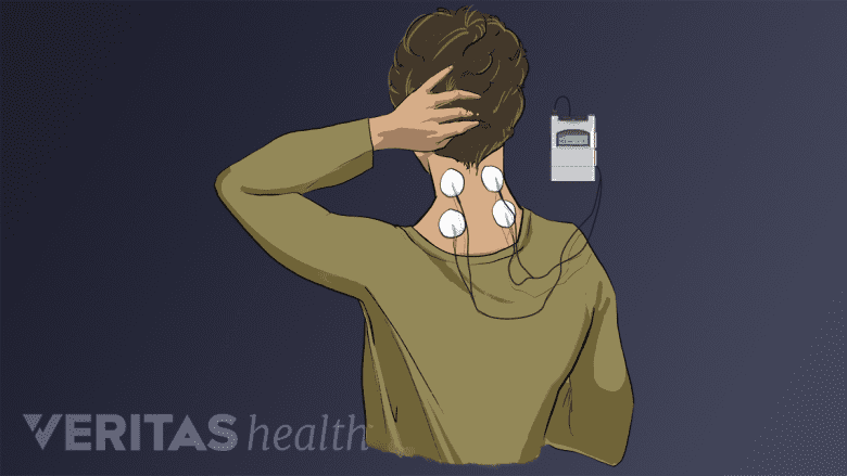 A TENs unit on a woman's neck.