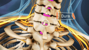 Posterior view of the cervical spine highlighting the dura in the epidural space.