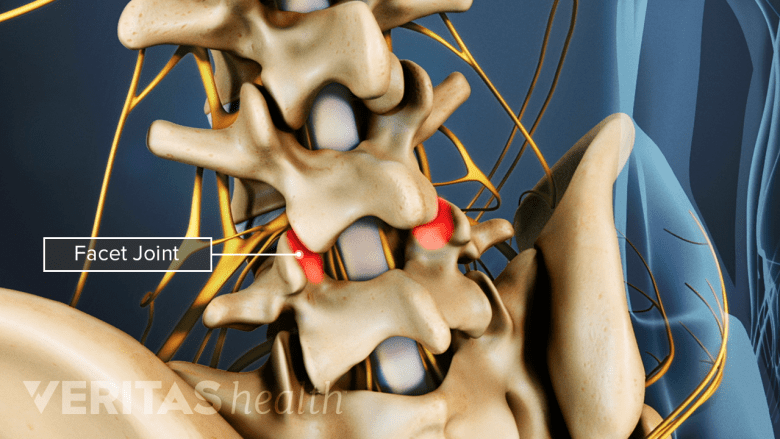 Illustration showing lumbar vertebra with facet joints highlighted in red.