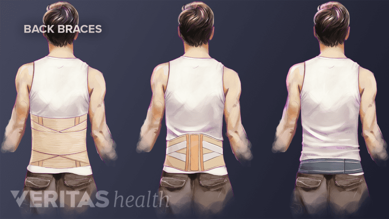 Illustration of corset, lumbar belt, and sacroiliac belt flexible braces for lower back pain