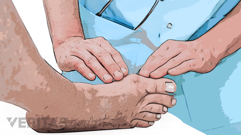 Filtered photo of a physician performing an exam on a patient's foot.