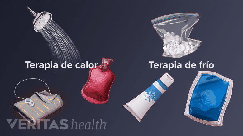 Terapias de frío y calor.