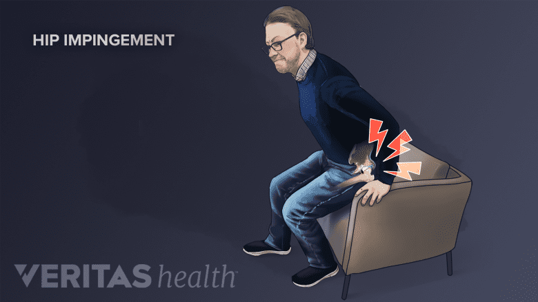 A man experiencing pain while moving from sitting to standing position.