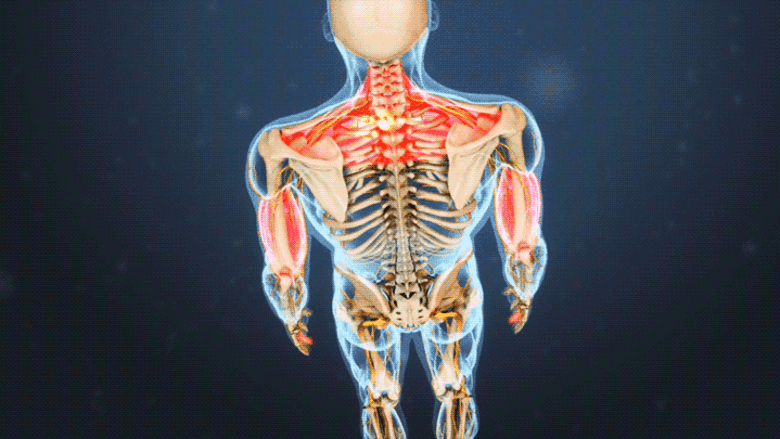 An illustration showing shoulder and both arms highlighted in red.