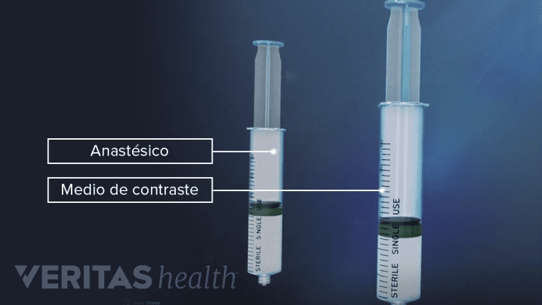 Los componentes de una inyección de bloqueos nerviosos.