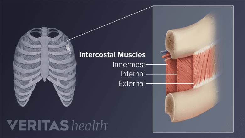 Medical illustration of intercostal muscle anatomy