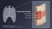 Medical illustration of intercostal muscle anatomy