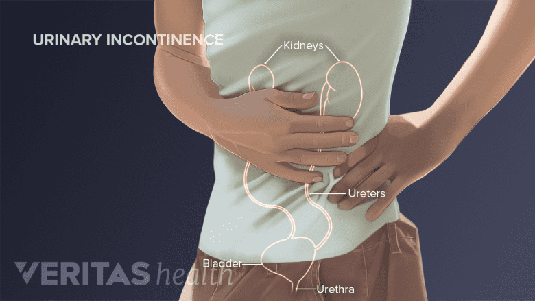 A man holding his stomach and an outline of kineys ureters and urethra.