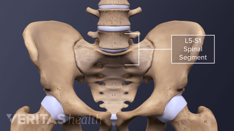 Anterior view of the spine and pelvis with the L5-S1 segment labeled.