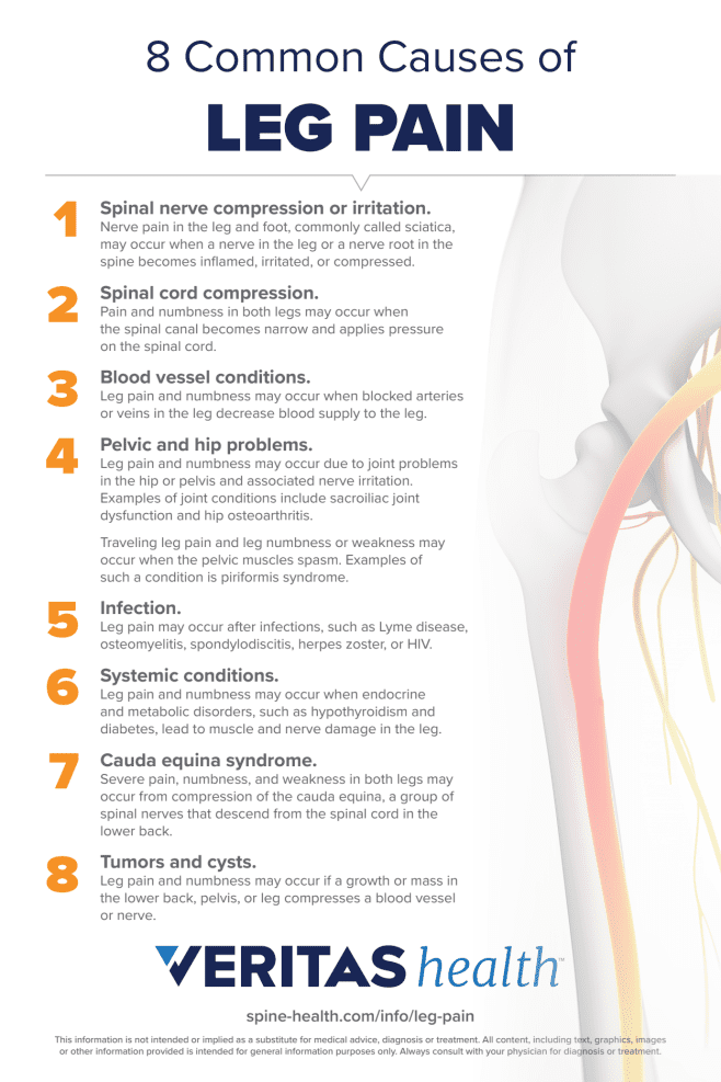Infographic of 8 Causes of Leg Pain